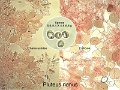 Pluteus nanus-amf1498-micro